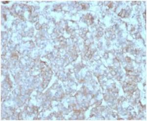 Immunohistochemical analysis of formalin-fixed, paraffin-embedded human adrenal gland tissue using Anti-MCP2 Antibody [CCL8/3312]