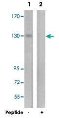 Anti-IRS1 Rabbit Polyclonal Antibody