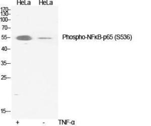 Western blot analysis of various cells using Anti-NF-kappaB p65 (phospho Ser536) Antibody