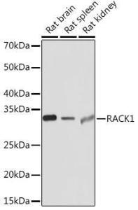 Western blot analysis of extracts of various cell lines, using Anti-RACK1 Antibody [ARC0837] (A305601) at 1:1,000 dilution. The secondary antibody was Goat Anti-Rabbit IgG H&L Antibody (HRP) at 1:10,000 dilution.