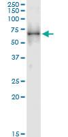 Anti-LYN Polyclonal Antibody Pair