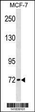 Anti-CPT2 Rabbit Polyclonal Antibody