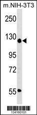 Anti-ADNP Rabbit Polyclonal Antibody (AP (Alkaline Phosphatase))