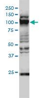 Anti-GTF3C2 Mouse Monoclonal Antibody [clone: 1C6-2B8]