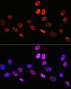 Anti-PABPN1 Rabbit Monoclonal Antibody [clone: ARC0730]