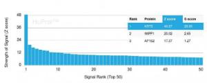 Analysis of protein array containing more than 19,000 full-length human proteins using Anti-Cytokeratin 5 Antibody [rKRT5/6398] Z-Score and S- Score