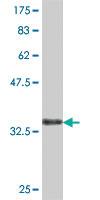 Anti-VPS41 Mouse Polyclonal Antibody