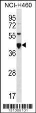 Anti-CEACAM18 Rabbit Polyclonal Antibody (FITC (Fluorescein Isothiocyanate))