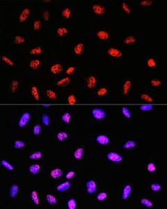 Anti-PABPN1 Rabbit Monoclonal Antibody [clone: ARC0730]