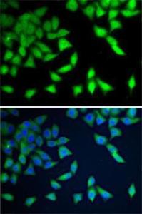 Anti-WDR77 Rabbit Polyclonal Antibody