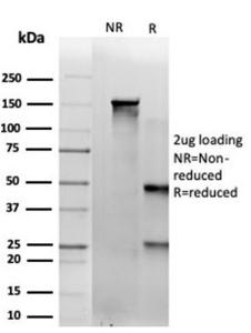 SDS-PAGE analysis of Anti-SAMD4B Antibody [PCRP-SAMD4B-1H3] under non-reduced and reduced conditions; showing intact IgG and intact heavy and light chains, respectively. SDS-PAGE analysis confirms the integrity and purity of the antibody