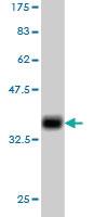 Anti-TNFRSF6B Mouse Monoclonal Antibody [clone: 7G5]