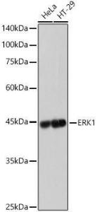 Western blot analysis of various lysates, using Anti-ERK1 Antibody [ARC2591] (A306776) at 1:1000 dilution