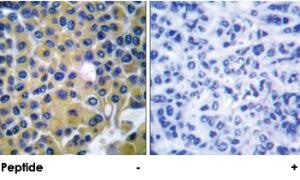 Anti-IRS1 Rabbit Polyclonal Antibody