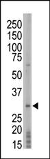 Anti-TP53RK Rabbit Polyclonal Antibody