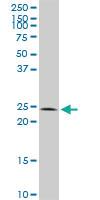 Anti-CBX5 Rabbit Polyclonal Antibody