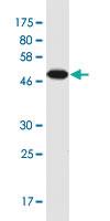 Anti-NOL3 Mouse Monoclonal Antibody [clone: 6F5]