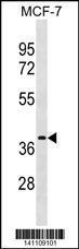 Anti-ESR1 isoform4 Rabbit Polyclonal Antibody (Biotin)