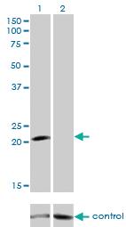 Anti-GUCA1A Mouse Monoclonal Antibody [clone: 2F7]