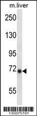 Anti-IKBKE Rabbit Polyclonal Antibody (HRP (Horseradish Peroxidase))