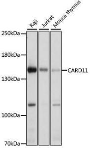 Western blot analysis of extracts of various cell lines, using Anti-Carma 1 / CARD11 Antibody (A12084) at 1:1,000 dilution. The secondary antibody was Goat Anti-Rabbit IgG H&L Antibody (HRP) at 1:10,000 dilution.