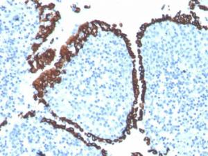 Immunohistochemical analysis of formalin-fixed, paraffin-embedded human tonsil using Anti-Cytokeratin 5 Antibody [KRT5/4245R]