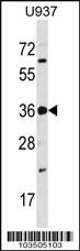 Anti-TP53RK Rabbit Polyclonal Antibody