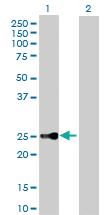 Anti-CBX5 Rabbit Polyclonal Antibody