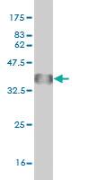 Anti-LHX4 Mouse Monoclonal Antibody [clone: 2B12]