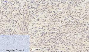 Immunohistochemical analysis of paraffin-embedded human uterus tissue using Anti-Smad3 Antibody at 1:200 (4°C overnight) Negative control was secondary antibody only