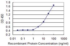 Anti-ASMT Mouse Monoclonal Antibody [clone: 1F8]