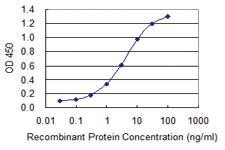 Anti-GUCA1B Mouse Monoclonal Antibody [clone: 5E7]