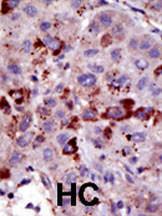 Anti-SUMO, Pan Rabbit Polyclonal Antibody (APC (Allophycocyanin))