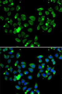 Immunofluorescence analysis of A549 cells using Anti-Carma 1 / CARD11 Antibody (A12084). DAPI was used to stain the cell nuclei (blue).