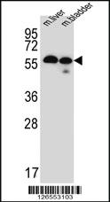 Anti-TMEM87B Rabbit Polyclonal Antibody