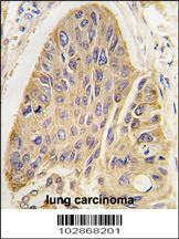 Anti-MAP2 Rabbit Polyclonal Antibody (APC (Allophycocyanin))