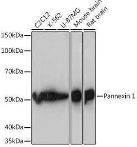 Western blot analysis of extracts of various cell lines, using Anti-Pannexin 1 Antibody [ARC1207] (A305603) at 1:1000 dilution. The secondary Antibody was Goat Anti-Rabbit IgG H&L Antibody (HRP) at 1:10000 dilution