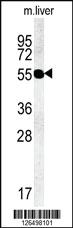 Anti-TMEM79 Rabbit Polyclonal Antibody