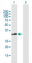 Anti-FAM64A Rabbit Polyclonal Antibody