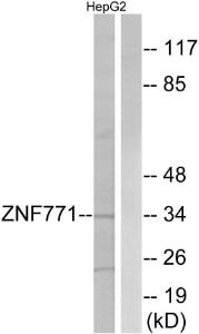 Western blot analysis of lysates from HepG2 cells using Anti-ZNF771 Antibody. The right hand lane represents a negative control, where the Antibody is blocked by the immunising peptide