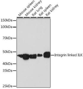 Western blot analysis of extracts of various cell lines, using Anti-Integrin linked ILK Antibody [ARC1037] (A308006) at 1:1000 dilution. The secondary Antibody was Goat Anti-Rabbit IgG H&L Antibody (HRP) at 1:10000 dilution