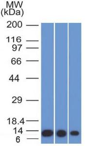 Western blot analysis of HeLa, A549, and A375 cell lysates using Anti-S100A4 Antibody [S100A4/1482]