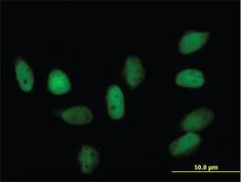 Anti-CBX5 Rabbit Polyclonal Antibody