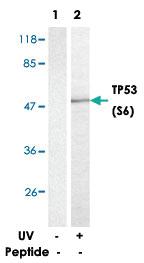 Anti-TP53 Rabbit Polyclonal Antibody