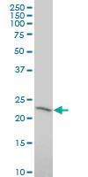 Anti-RNF182 Mouse Polyclonal Antibody