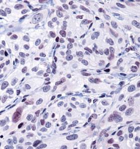 Anti-HIST3H3 Rabbit Polyclonal Antibody (HRP (Horseradish Peroxidase))