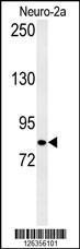 Anti-CQ028 Rabbit Polyclonal Antibody (Biotin)