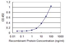 Anti-STIM1 Mouse Monoclonal Antibody [clone: 1B12]