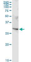 Anti-FAM64A Rabbit Polyclonal Antibody