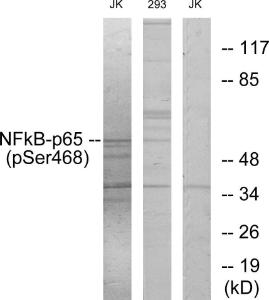 Western blot analysis of lysates from Jurkat cells and 293 cells using Anti-NF-kappaB p65 (phospho Ser468) Antibody. The right hand lane represents a negative control, where the antibody is blocked by the immunising peptide.